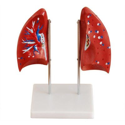 MODELO PULMONAR DIDÁTICO EM 04 PARTES