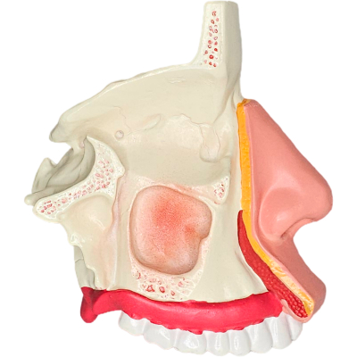 MODELO DA CAVIDADE NASAL AMPLIADO 1/2x